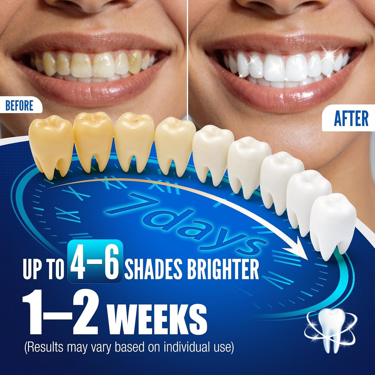Teeth Whitening Pen Kit - 35% Carbamide Peroxide, Stain Removal, 4 Whitening Pens + 2 Remineralizing Pens, Enamel Repair, Anti-Cavity, Sensitive Teeth Care, 6 X 0.14 Fl Oz(Mint)