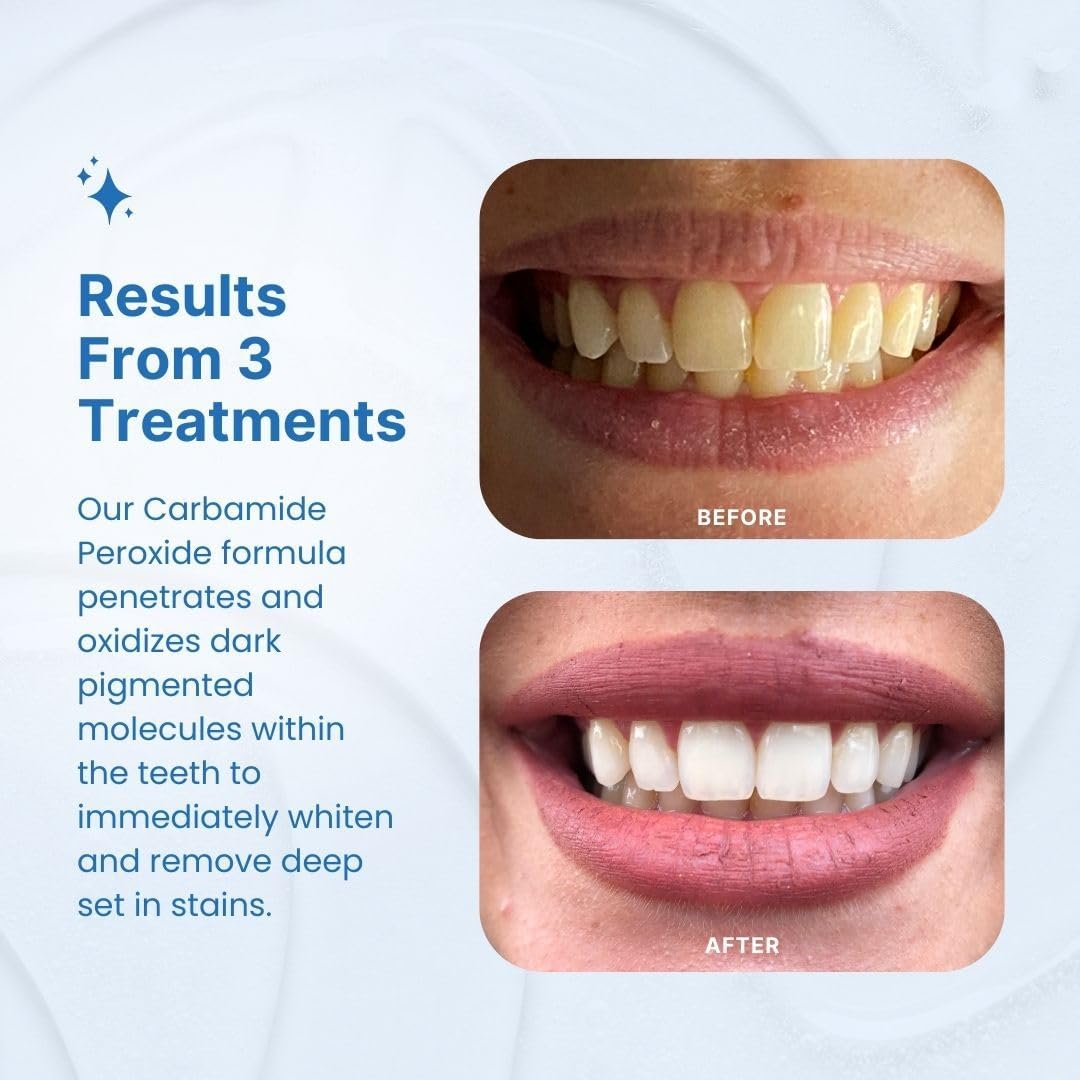 Draws attention to the core whitening mechanism and included accessories.