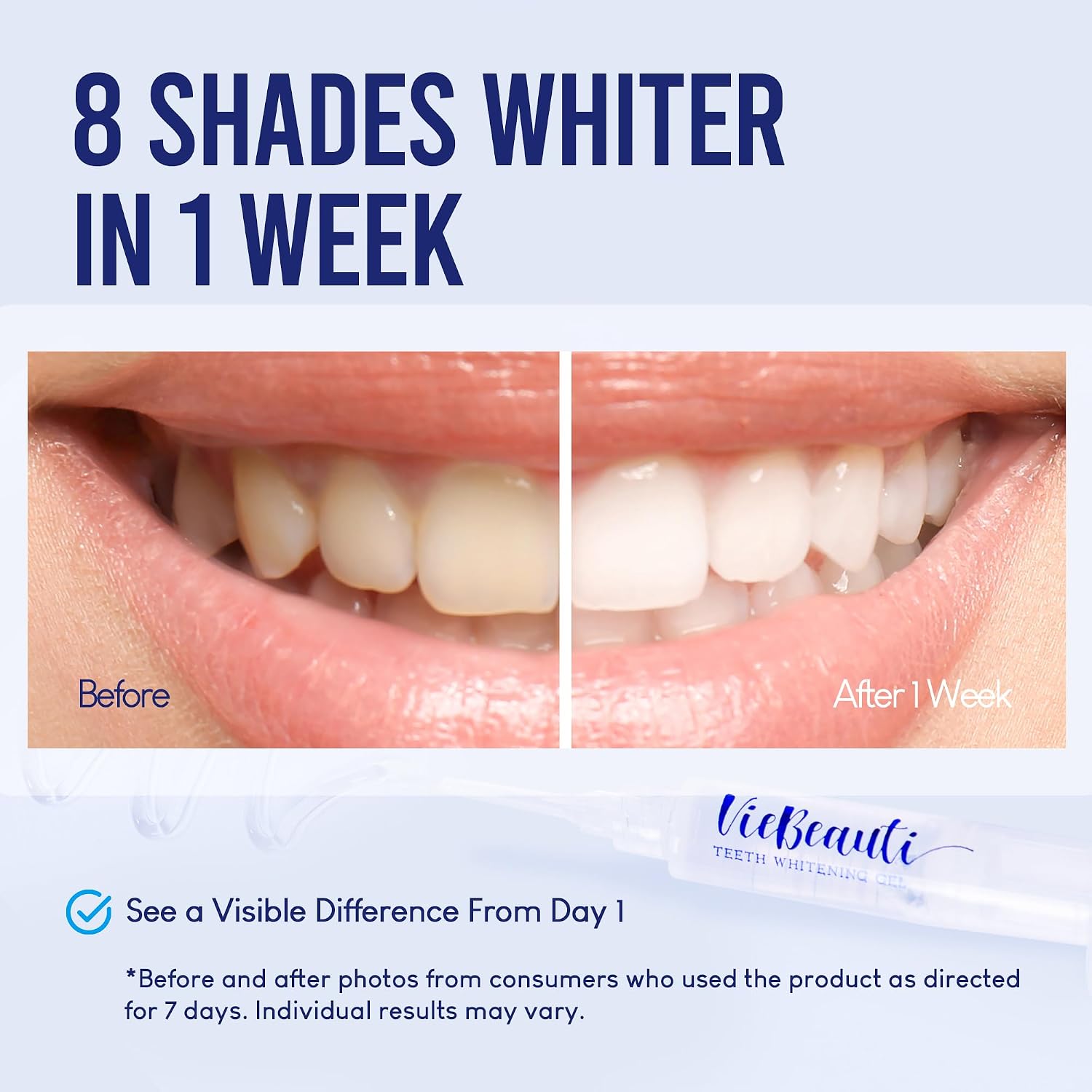 Viebeauti Teeth Whitening Kit With LED Light For Sensitive Teeth, 35% Carbamide Peroxide, Remineralizing Gel For Fast Results Cool Mint