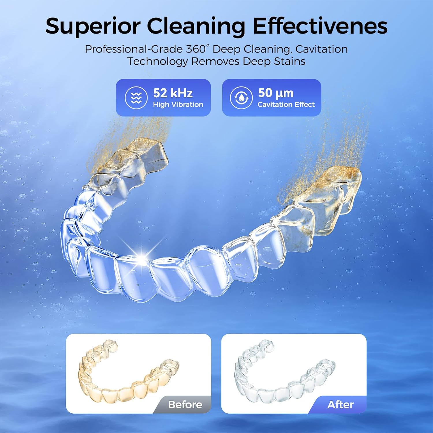 Draws attention to usability and the internal cleaning space, which matters for retainers, guards, and small accessories.