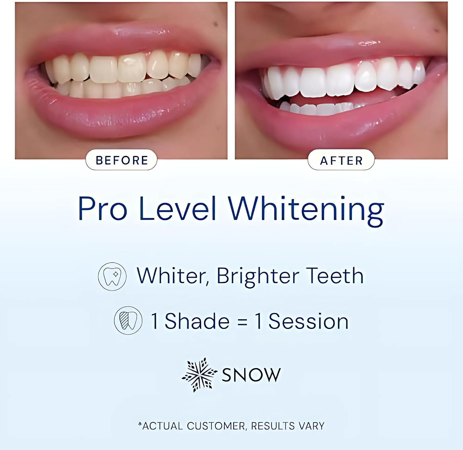 Snow Teeth Whitening Kit - Wired LED Mouthpiece Whitener - 1 Pen