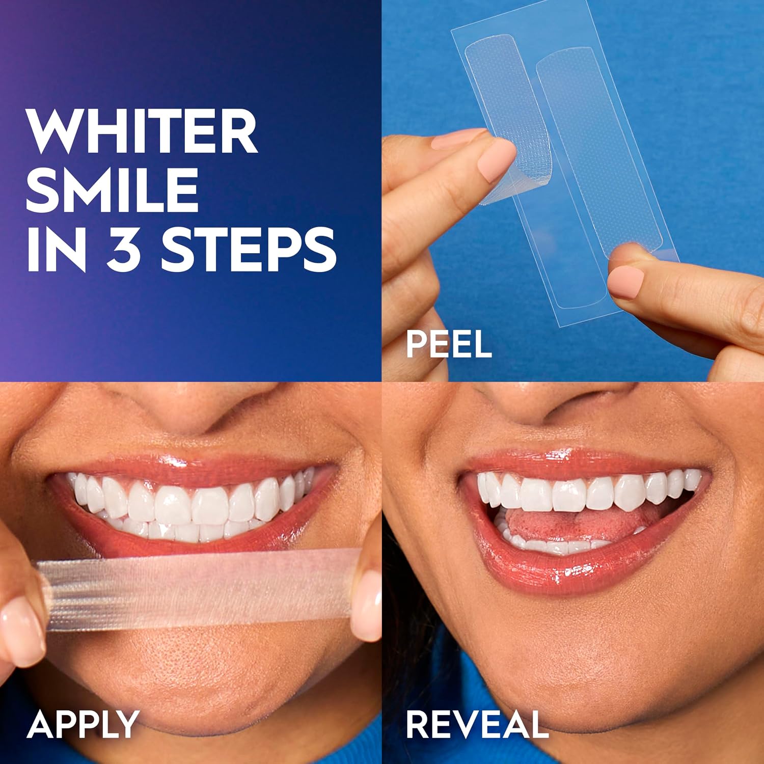 Fit, design, and treatment format for upper and lower teeth.
